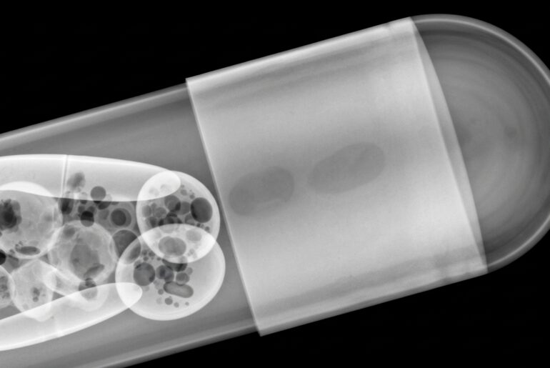 An extreme macro X-ray photograph showing the translucent internal structure of a dietary supplement capsule, conceptually representing the hidden allergens that led to a product recall.