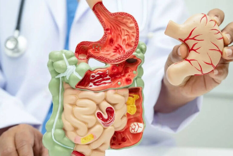 Autoimmune diseases may start in the gut: Early signs your immune system is turning against you and what you can do to restore balance