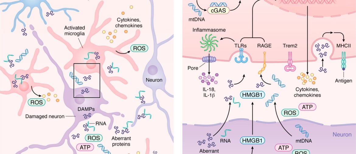 How the immune system may influence Alzheimer’s, Parkinson’s, and related diseases