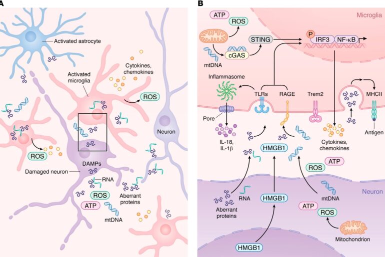 How the immune system may influence Alzheimer’s, Parkinson’s, and related diseases