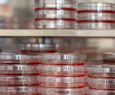 MSU researchers find how HPV-connected cancers hide from immune system, how to expose them