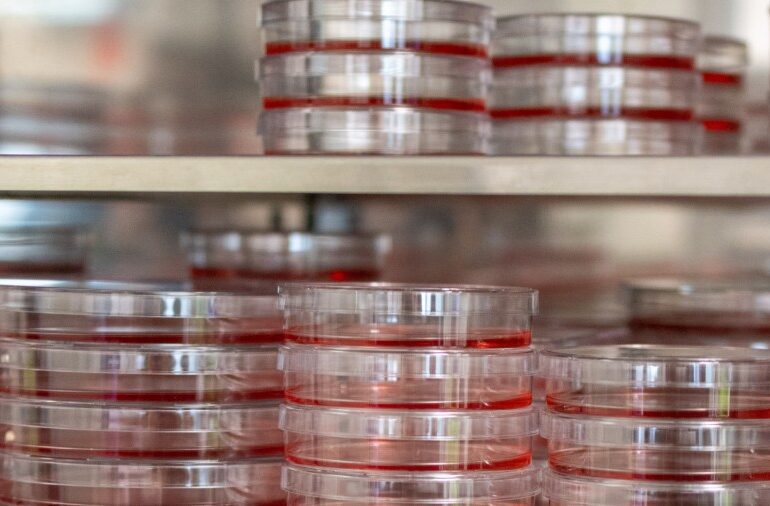 MSU researchers find how HPV-connected cancers hide from immune system, how to expose them