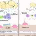 Bone marrow fat-driven immune suppression and bone loss pathway