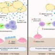 Bone marrow fat-driven immune suppression and bone loss pathway