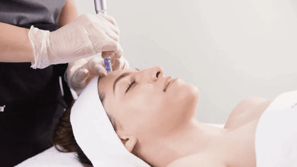 Sharp Standards Guide to Microneedling : The British Beauty Council