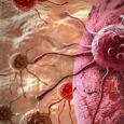 New immune mapping tool reveals how lung cancer reshapes immune cells