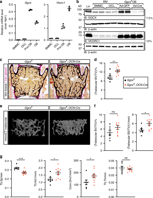 Vitamin K-dependent carboxylation in osteoblasts regulates bone resorption through GAS6 in male mice