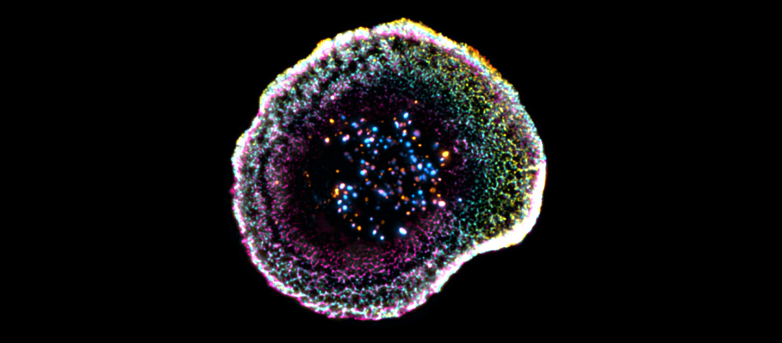 Unprecedented View Of Immune System's Killer Cells
