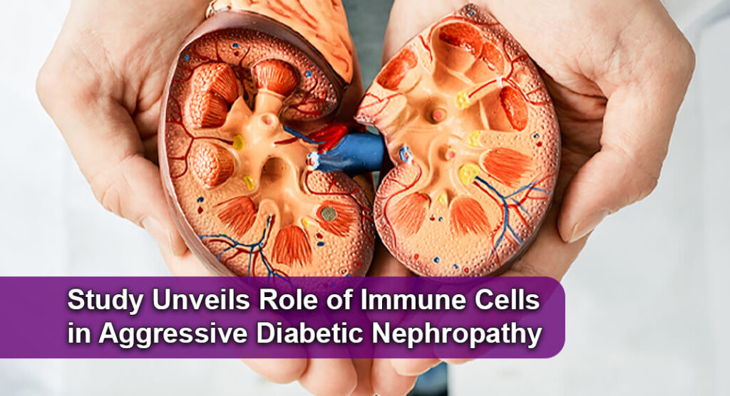 Scientists Discover Immune-Linked Variant of Diabetic Kidney Disease