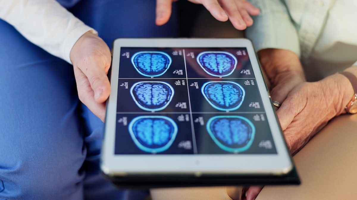 Doctor examining brain scan images on a tablet with patient and nurse nearby