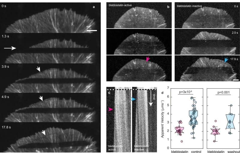 Transport of depolymerized actin to the polymerizing front is facilitated by myosin contraction. (CREDIT: Nature Communications)