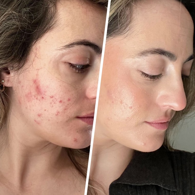 Before (left) and after (right)