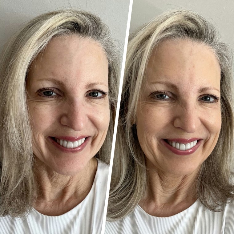 Before (left) and after (right)