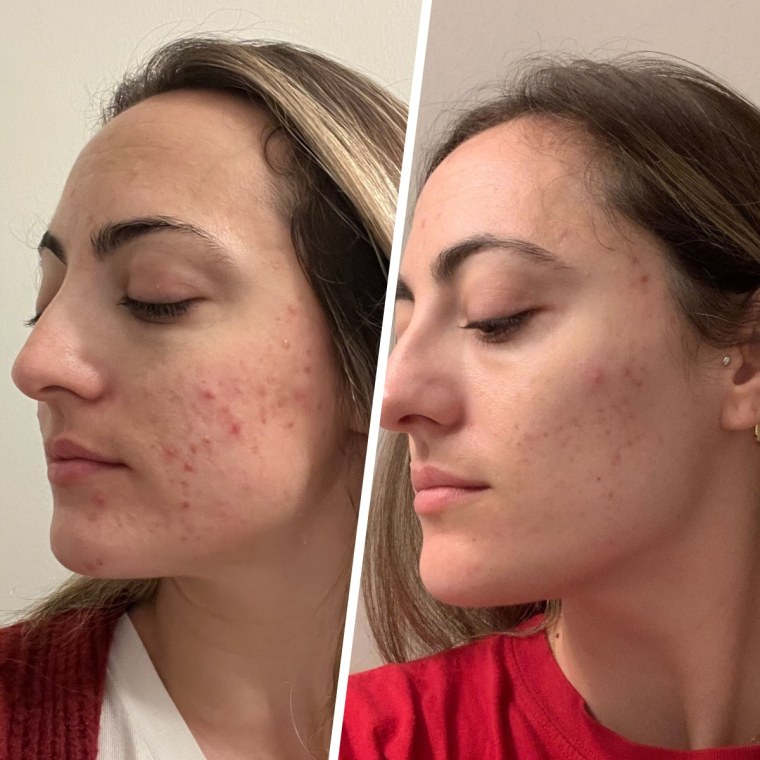 Before (left) and after (right)