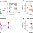 Immunological and prognostic impact of NRF2 in high grade serous ovarian cancer