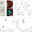 A root-based N-hydroxypipecolic acid standby circuit to direct immunity and growth of Arabidopsis shoots