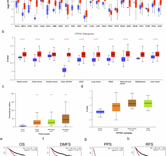 MCT4 deficiency suppresses tumor incidence and metastasis by downregulating IGF1 expression and enhancing anti-tumor immunity