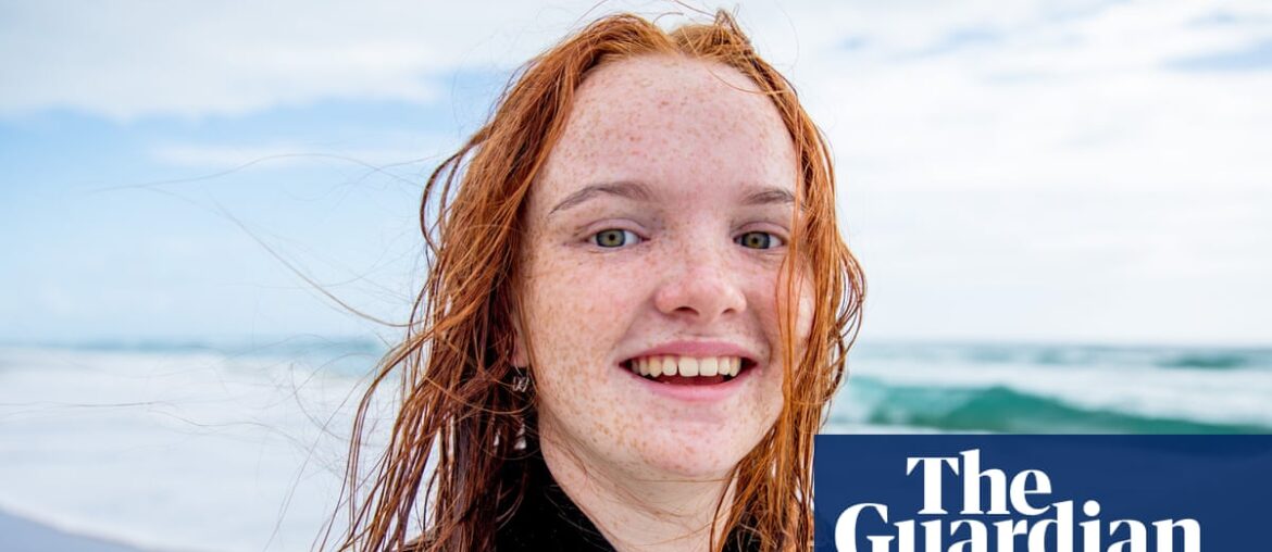 Red hair gene favoured by natural selection over last 10,000 years, study finds