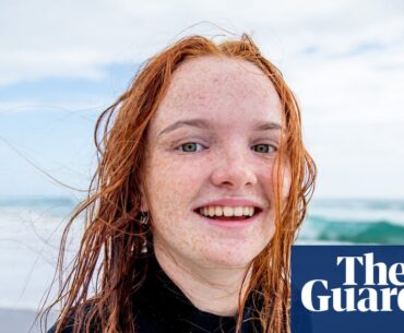 Red hair gene favoured by natural selection over last 10,000 years, study finds
