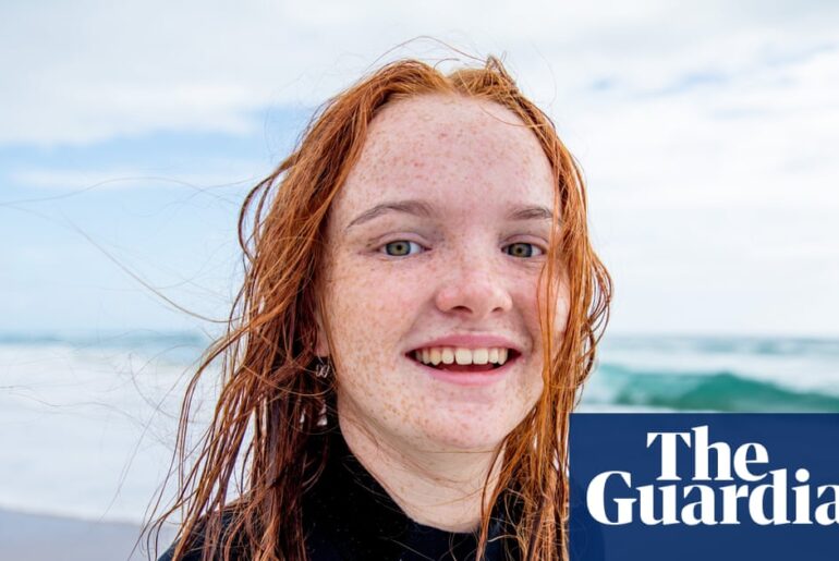 Red hair gene favoured by natural selection over last 10,000 years, study finds