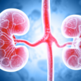 Immune linked high risk diabetic kidney disease found