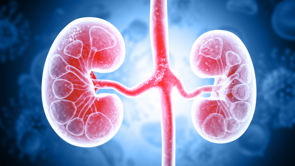 Immune linked high risk diabetic kidney disease found