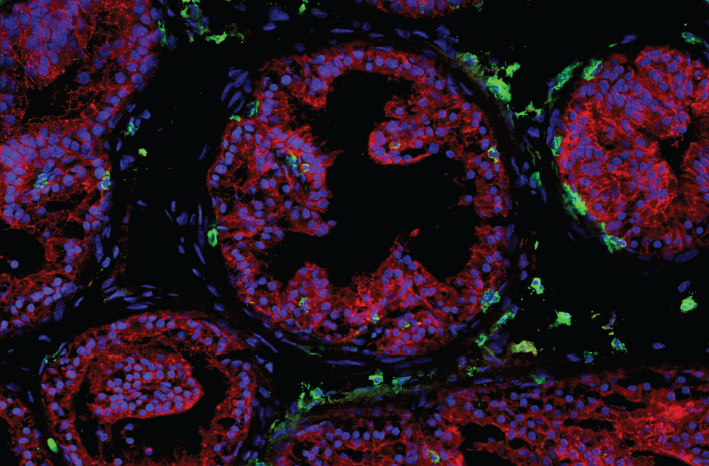 Scientists discover how key immune cells protect the prostate