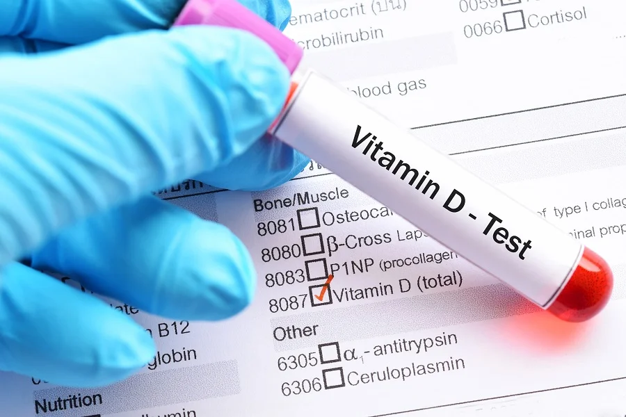 Vitamin D blood test