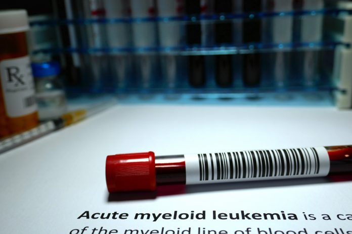 Acute myeloid leukemia