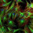 Fibroblast subtype found to be essential for coordinating immune cells within lymph nodes