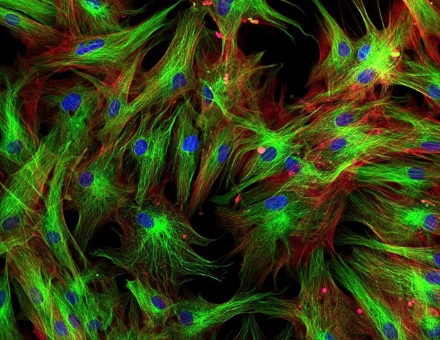 Fibroblast subtype found to be essential for coordinating immune cells within lymph nodes