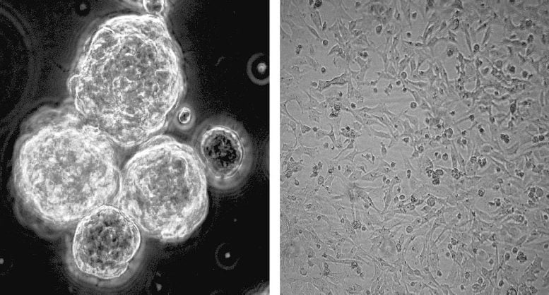 Glioblastoma Cell Clustering With and Without Niacin