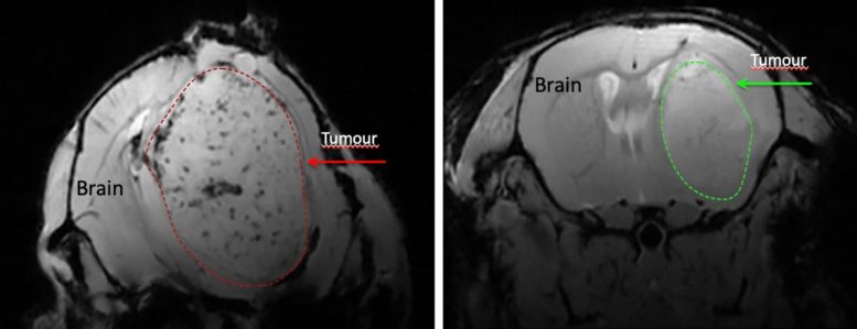 Mouse Brain Tumor Growth With Niacin Treatment