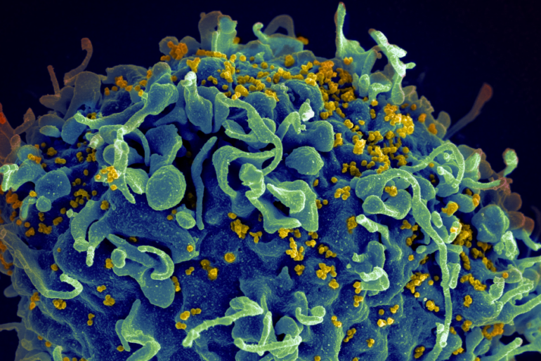 UNC Researchers Demonstrate Drug’s Effectiveness in Drawing Out Dormant HIV from Immune Cells