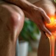 Clinical Evidence How Collagen Supplementation Affects Joint Health and Osteoarthritis