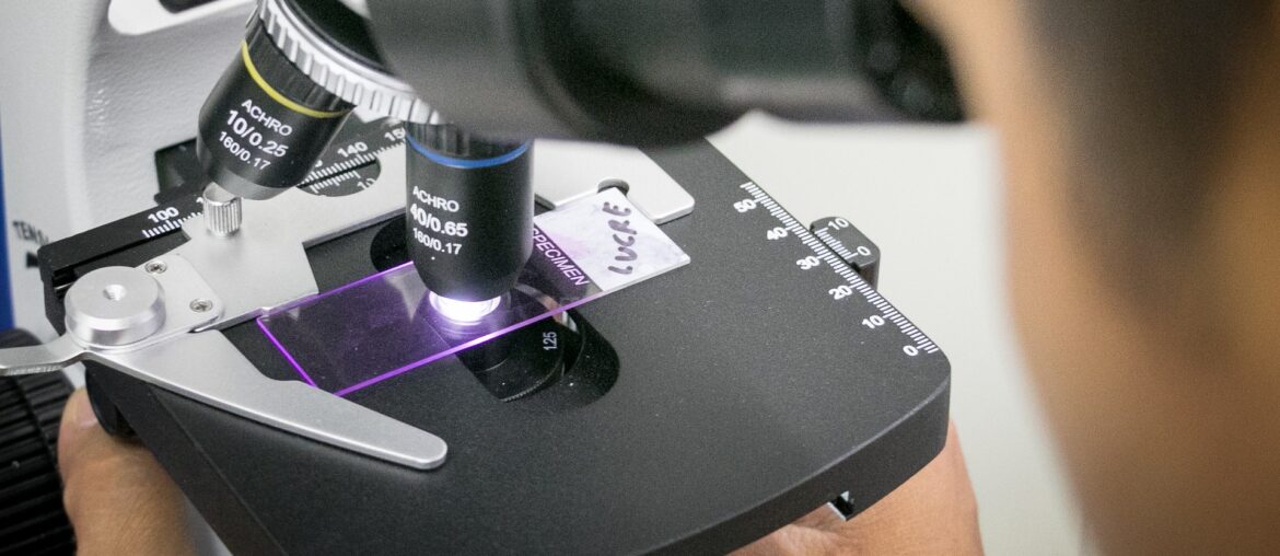 Polarized Immune Cells Inhibit Treatment Efficacy in Pancreatic Cancer