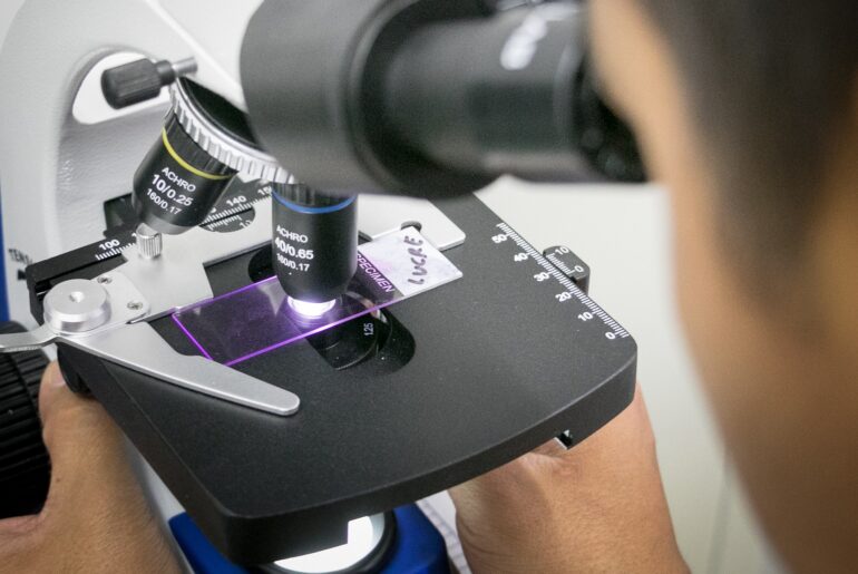 Polarized Immune Cells Inhibit Treatment Efficacy in Pancreatic Cancer