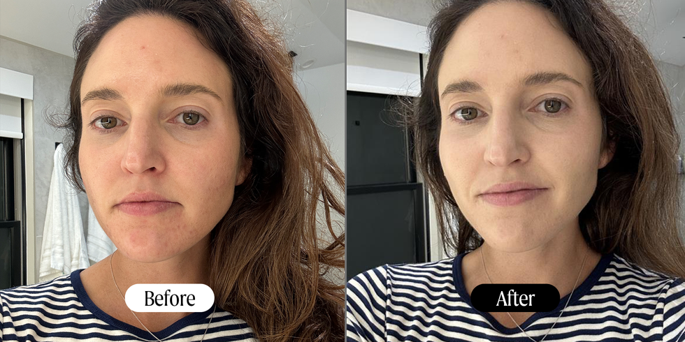 Comparison of changes before and after a treatment. Comparison of changes before and after a treatment.