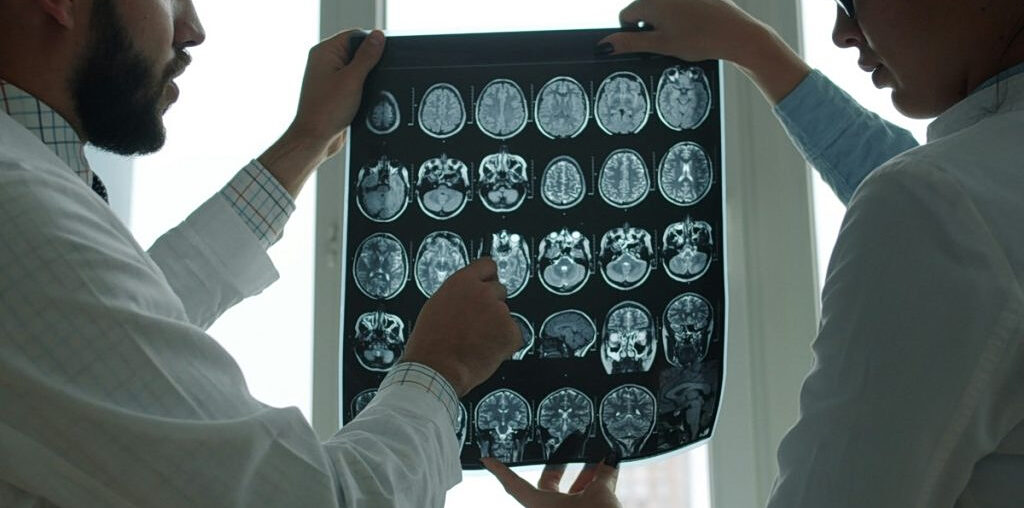 Vitamin D Levels Linked to Lower Dementia Risk