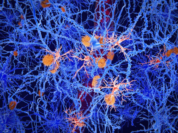 An image of microglia, immune cells that are one of the causes of worsening Alzheimer's disease. Provided by Getty Images Bank.