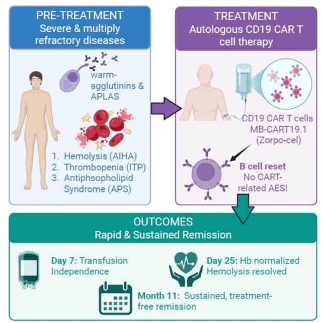 Immune System 'Reset' Puts Patient With 3 Autoimmune Diseases in Remission