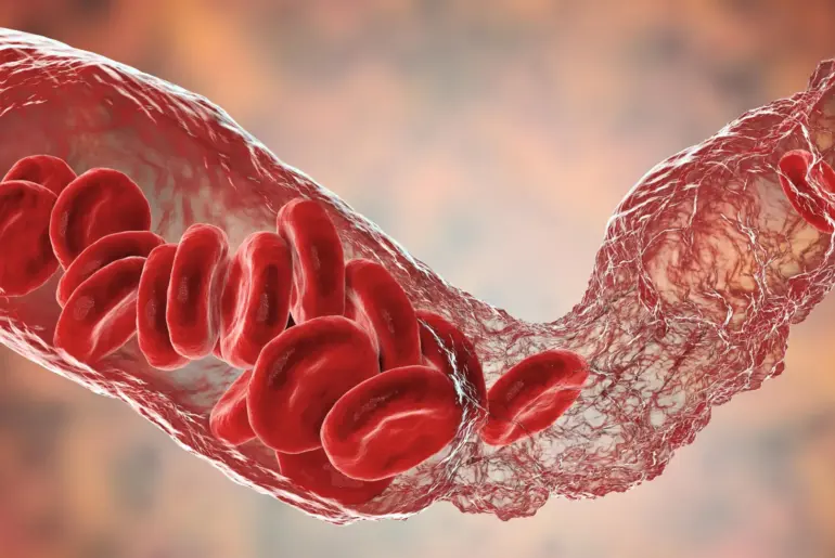 Scientists finally crack mystery of rare COVID vaccine blood clots