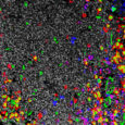 Discovery of immune tolerance switch could yield better IBD treatments