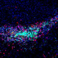 T cells secrete DNA to help immune system fight cancer