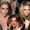 Kesha regrets 'horrible filler phase' and talks impossible beauty standards