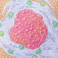 From Salk Institute discovery to patient care: Vitamin D analog shuts down pancreatic cancer’s shield in clinical trial