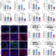 Chronic stress drives oligoasthenozoospermia via gut microbiota-vitamin-Sting1/Slc9c2 axis