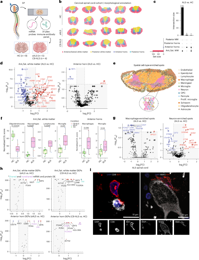 Integrated single-cell and spatial transcriptomic profiling in ALS ...