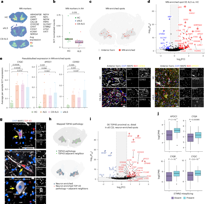 Integrated single-cell and spatial transcriptomic profiling in ALS ...