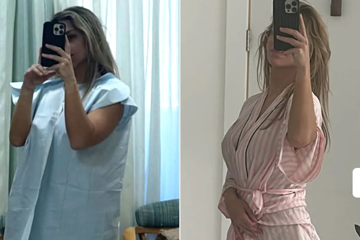 After a ‘Tear During Birth,’ Fitness Influencer Sought a Labiaplasty for Repair and Documented It on Social Media
